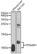 p53AIP1 Polyclonal Antibody