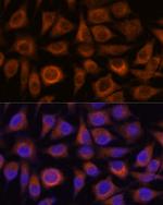 TRIM16 Antibody in Immunocytochemistry (ICC/IF)
