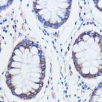 TRIM16 Antibody in Immunohistochemistry (Paraffin) (IHC (P))
