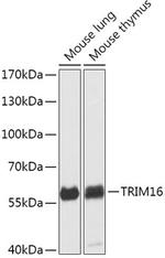 TRIM16 Antibody in Western Blot (WB)