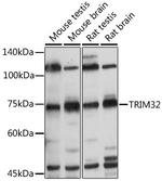 TRIM32 Polyclonal Antibody