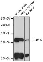TRIM37 Polyclonal Antibody