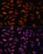 TRIM47 Antibody in Immunocytochemistry (ICC/IF)