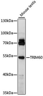 TRIM60 Polyclonal Antibody