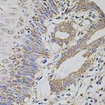 TRMT2A Polyclonal Antibody