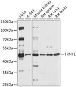 TRNT1 Polyclonal Antibody