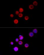 TRPC5 Polyclonal Antibody