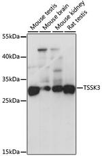 TSSK3 Polyclonal Antibody