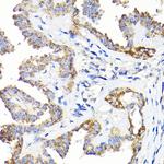 TST Polyclonal Antibody
