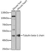 TUBB1 Antibody in Western Blot (WB)