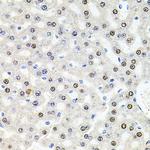 SR140 Antibody in Immunohistochemistry (Paraffin) (IHC (P))