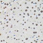 SR140 Polyclonal Antibody