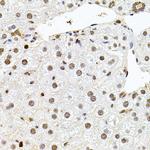 SR140 Antibody in Immunohistochemistry (Paraffin) (IHC (P))