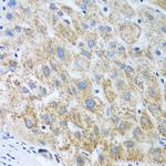 UBE2U Antibody in Immunohistochemistry (Paraffin) (IHC (P))