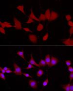 UCHL5 Polyclonal Antibody