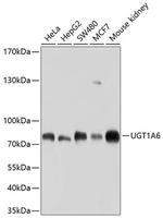 UGT1A6 Polyclonal Antibody