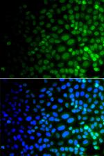 ULK4 Polyclonal Antibody