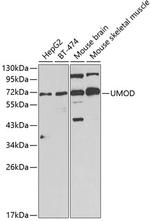 Uromodulin Polyclonal Antibody