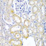 UPF2 Antibody in Immunohistochemistry (Paraffin) (IHC (P))