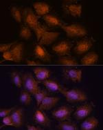 UPF3A Antibody in Immunocytochemistry (ICC/IF)