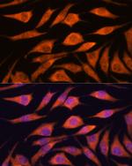 UPF3A Polyclonal Antibody