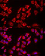 USP21 Antibody in Immunocytochemistry (ICC/IF)