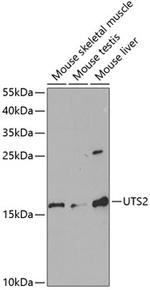 UTS2 Polyclonal Antibody