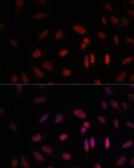 WDR18 Polyclonal Antibody