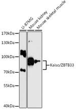 Kaiso Antibody in Western Blot (WB)