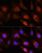 ZC3H12D Polyclonal Antibody