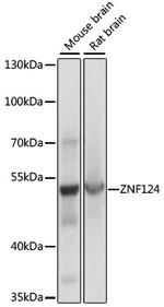 ZNF124 Polyclonal Antibody