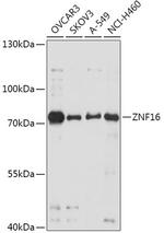 ZNF16 Polyclonal Antibody