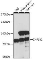 ZNF182 Polyclonal Antibody