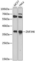ZNF346 Antibody in Western Blot (WB)