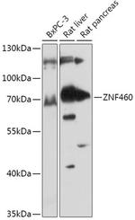 ZNF460 Polyclonal Antibody