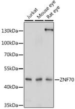ZNF70 Polyclonal Antibody
