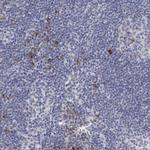 DKC1 Antibody in Immunohistochemistry (Paraffin) (IHC (P))