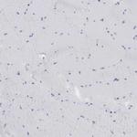 DKC1 Antibody in Immunohistochemistry (Paraffin) (IHC (P))