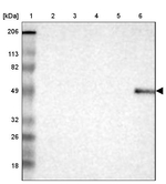 DKC1 Antibody in Western Blot (WB)