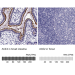 ACE2 Polyclonal Antibody