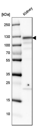 ACE2 Antibody in Western Blot (WB)