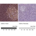 CD45 Antibody in Immunohistochemistry (Paraffin) (IHC (P))