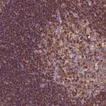 CD45 Antibody in Immunohistochemistry (Paraffin) (IHC (P))