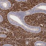 Galectin 1 Polyclonal Antibody