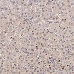 Galectin 1 Antibody in Immunohistochemistry (Paraffin) (IHC (P))