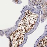 Galectin 1 Antibody in Immunohistochemistry (Paraffin) (IHC (P))