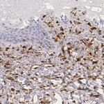 Galectin 1 Antibody in Immunohistochemistry (Paraffin) (IHC (P))