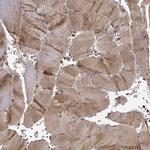 TRMU Antibody in Immunohistochemistry (Paraffin) (IHC (P))
