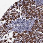 MLK1 Antibody in Immunohistochemistry (Paraffin) (IHC (P))