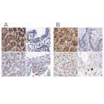alpha Galactosidase Polyclonal Antibody